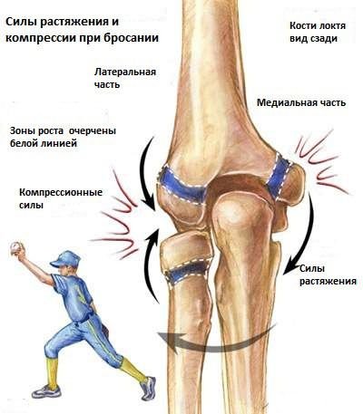 deformáló artrosis a bal boka ízületében)