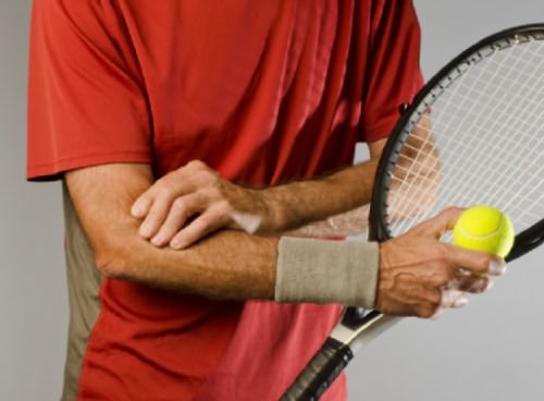 Teniszkönyök 5 oka, 4 tünete, 9 kezelési módja [teljes tudásanyag]
