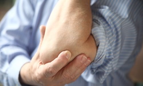 hogyan lehet enyhíteni a fájdalmat az ujjak artritiszével