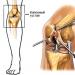 Symptomatická liečba: ako zmierniť bolesť kĺbov