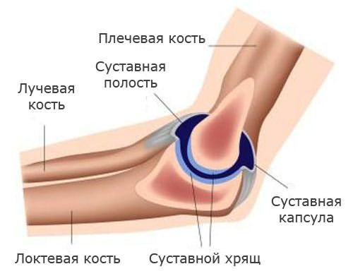 deformáló könyökízület osteoarthrosis
